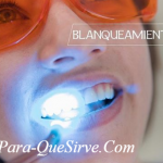  ¿Para Qué Sirve El Tratamiento De Blanqueamiento Dental?